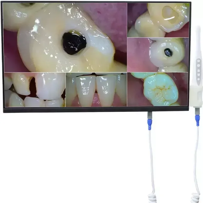The most sold Computer HD Touch Screen Endoscopic Equipment Dental Wifi HD 1080P Intraoral Camera