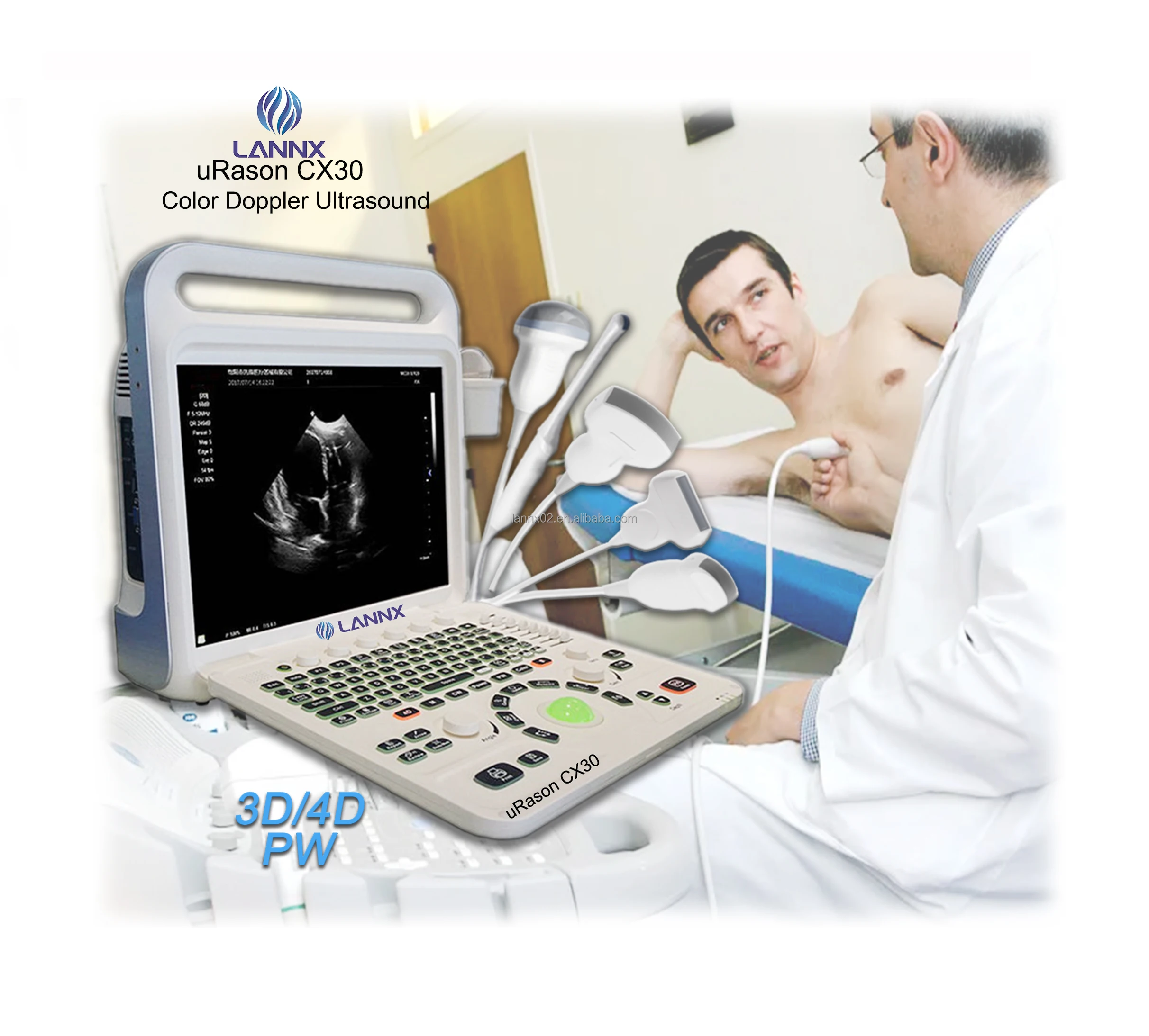 LANNX uRason CX30 Customized Laptop Digital Cardiology Ultrasound machine Color Doppler ultrasonido scanner ecografo portatil