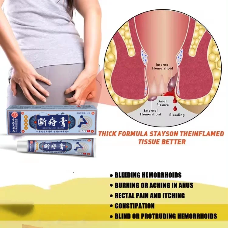 New arrival health care cream Bleeding hemorrhoids Burning pain of anus Treatment Relief Pain Hemorrhoids Ointment 20g