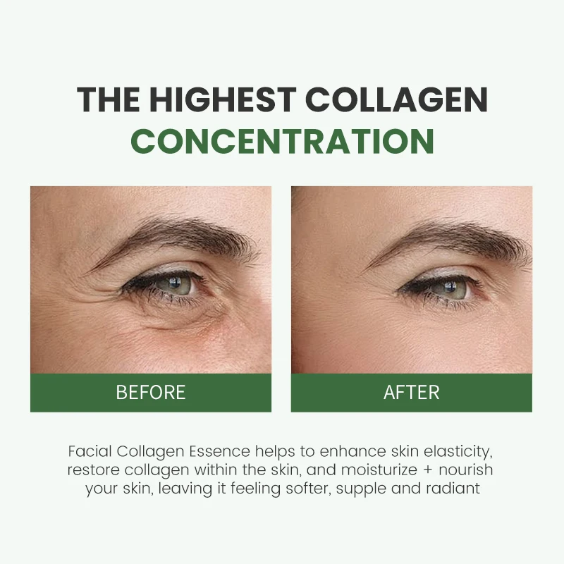 Custom Private Label Collagen Boost Renewal Serum Collagen Boost Erase Fine Lines Deep Wrinkles Dark Spots Essence OEM