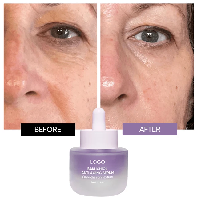 Oem Factory Smooths Skin Firm Antioxidant Squalane Retinol Alternative 30ml Face Serum Bakuchiol Serum