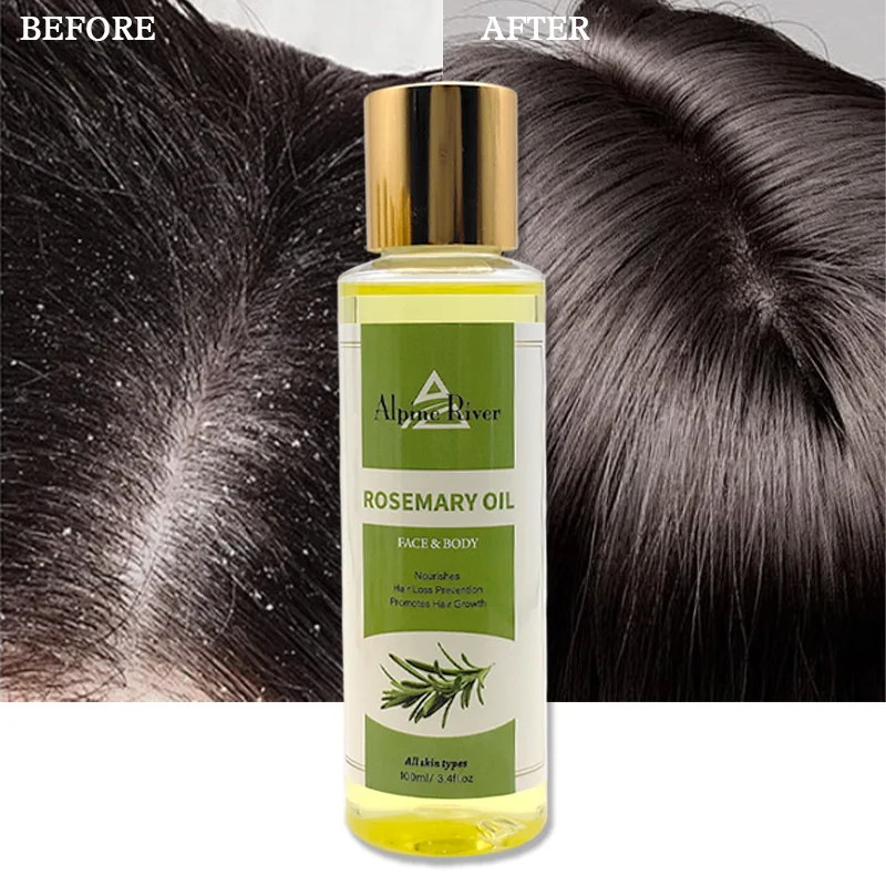 Private Label Alpine River 100% Natural Organic Vegetarian Prevents Hair Loss Body Moisturizing Rosemary Hair Growth Oil
