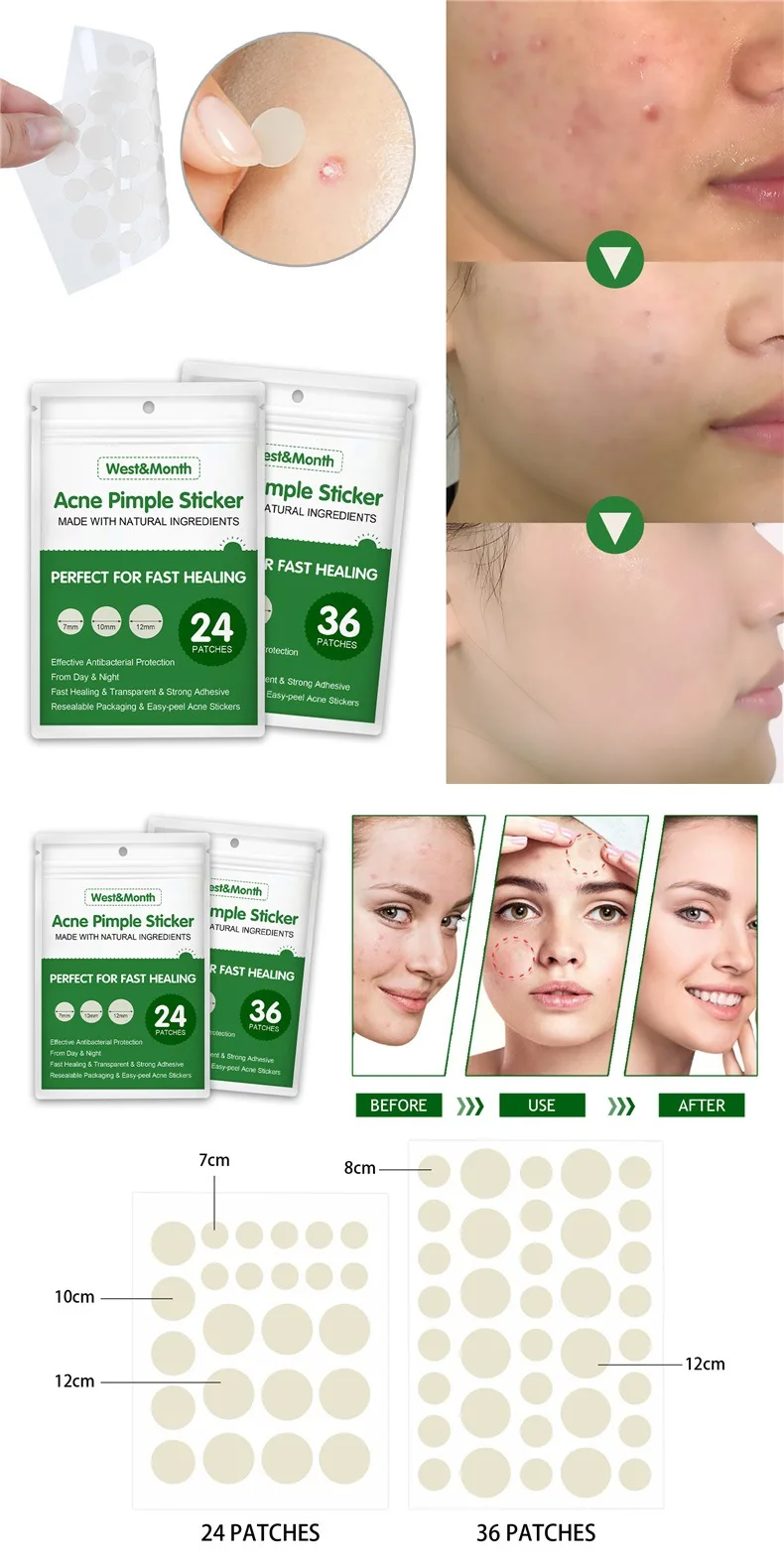 Free Sample Acne Dressing Acne Patch Custom Shape Spot Treatment Plaster Acne Patches Invisible