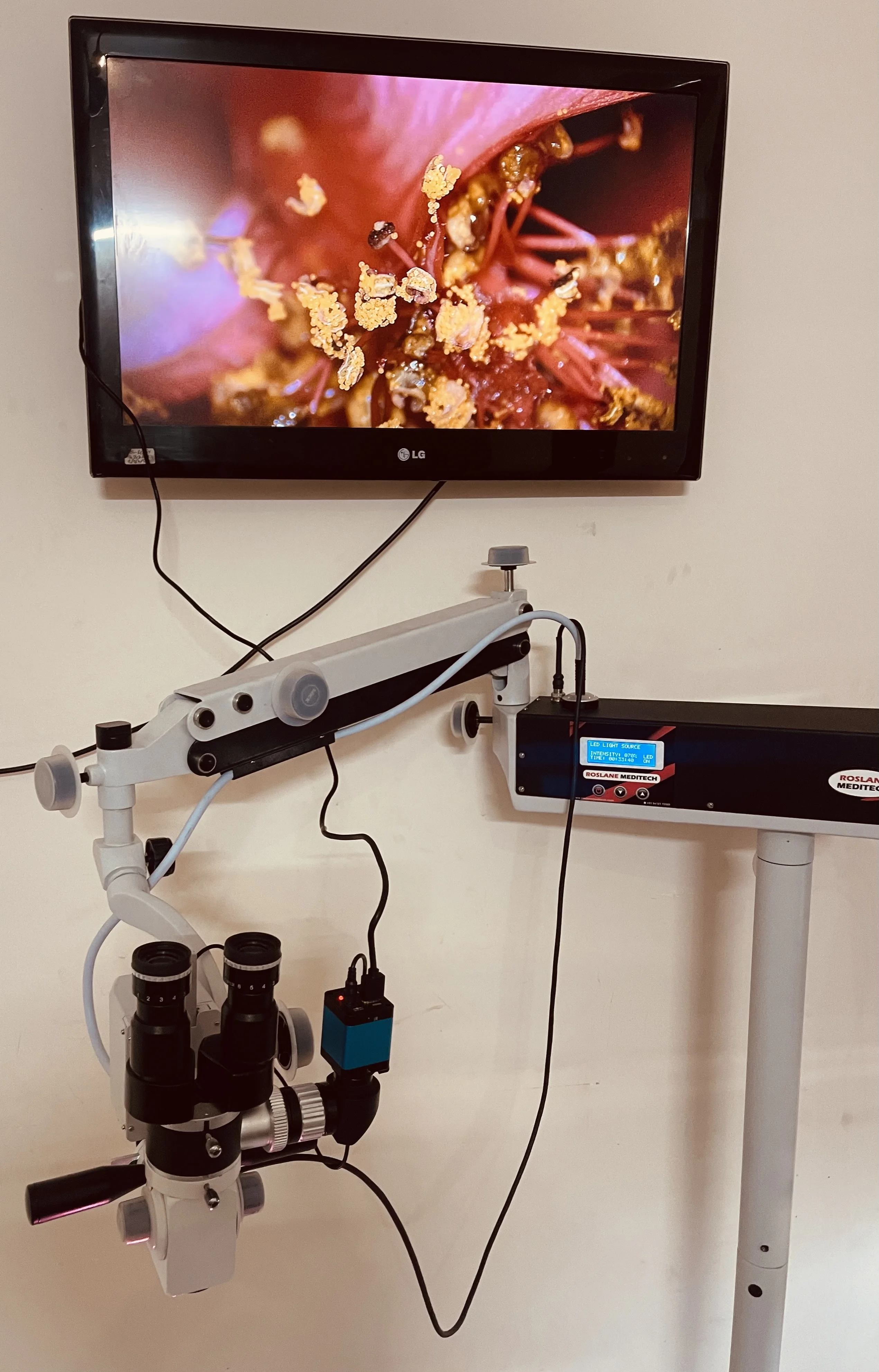 Indian Supplier Ophthalmic Microscope for Surgical Eye Operation ENT Surgical Operating Examination Made of Steel