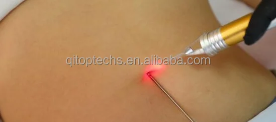 Diode Laser Vaser Lipo Equipment Cold Lipolysis Liposuction Belly Fat Reducing Device Slimming Machine