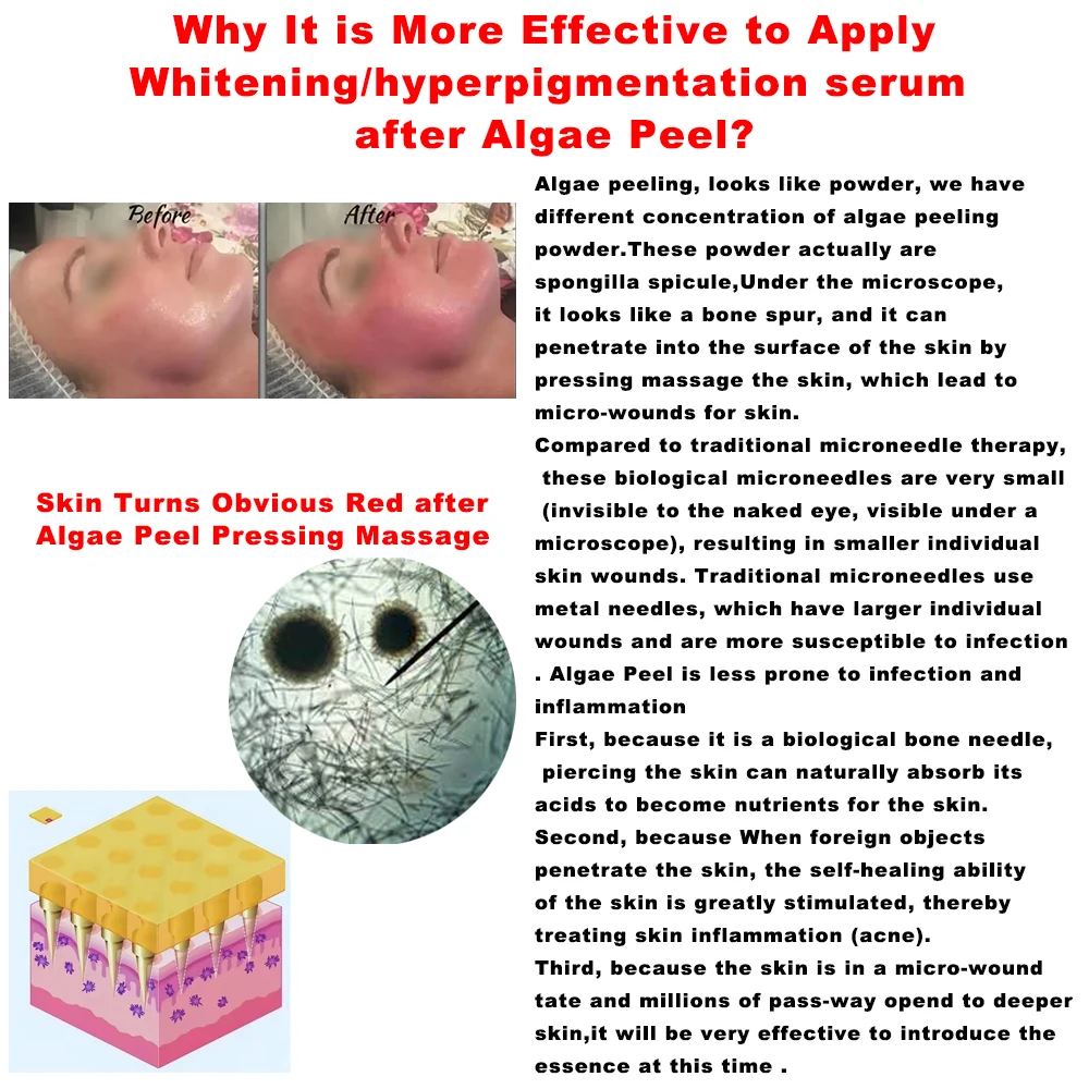 Epidermal Growth Factors Healing Power EGF Human Korea Like for Post Algae Chemical Peel Microneedling Micro Needling Serum