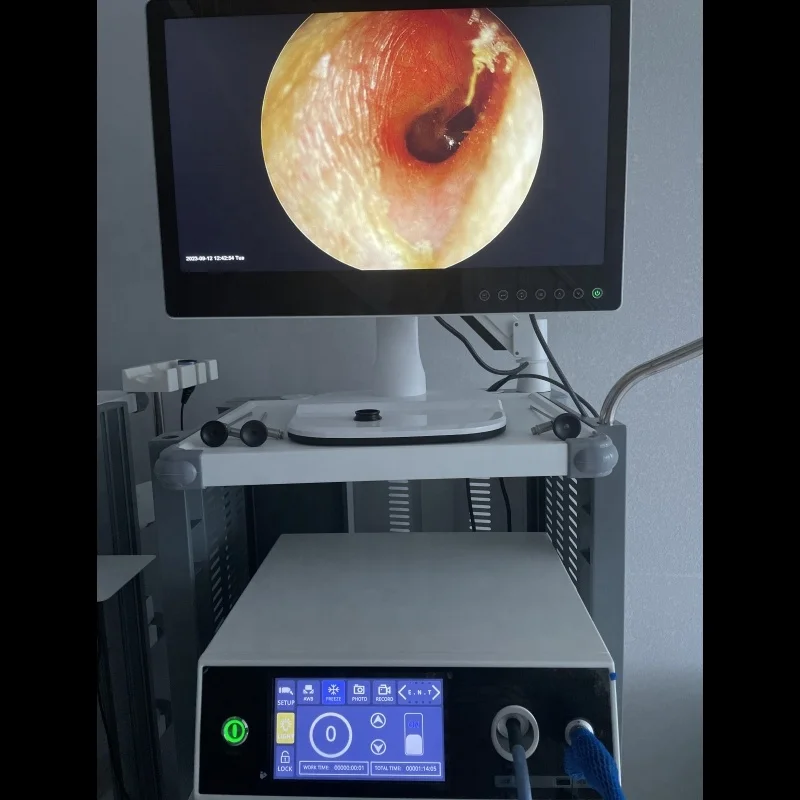 Hospital multi function integrated full HD endoscope camera for laparoscopy endoscope system