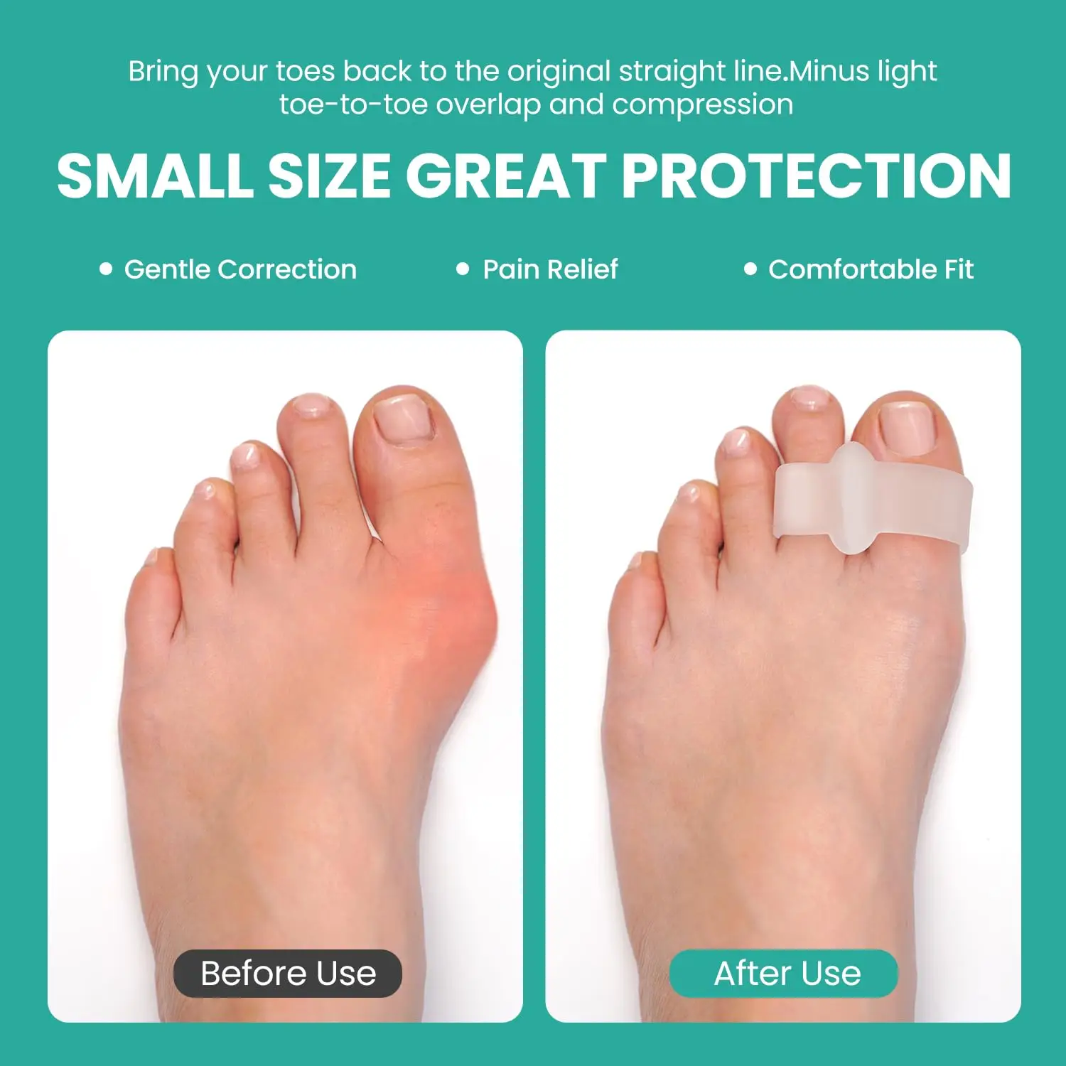 Clear Aloe Extract Gel Big Toe sleeve 2 loop Splitter Cushions Corrector protector Silicone Separator for Bunion and Overlap Toe