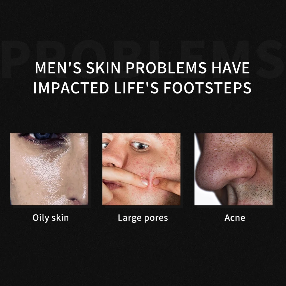 Acne Kit Peeling Korean Organic Facial Products Anti Acne Treatment Pores Salicylic Glycolic Acid Skin Care Set For Men Acne