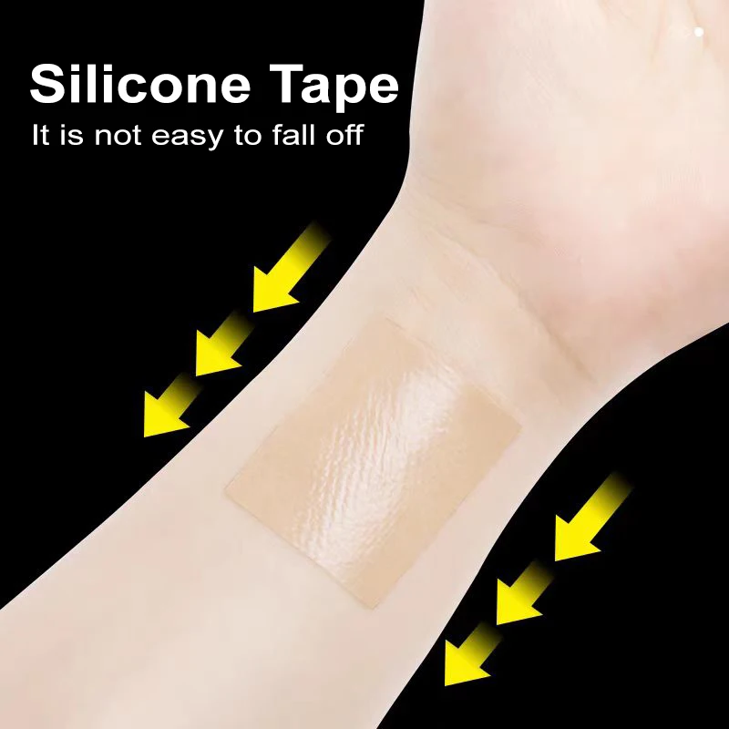 High quality Silicone matte tape tpu beige brown cream medical surgical grade tape roll wound care product Scar Tape