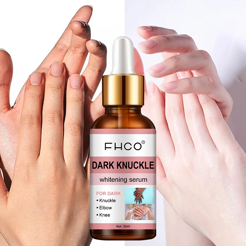 Custom 30ml Good Molecules Discoloration Correction Dark Knuckle Skin Brightening Glycerin Niacinamide Hand Whitening Serum