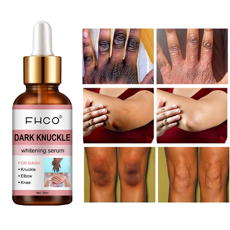 Custom 30ml Good Molecules Discoloration Correction Dark Knuckle Skin Brightening Glycerin Niacinamide Hand Whitening Serum