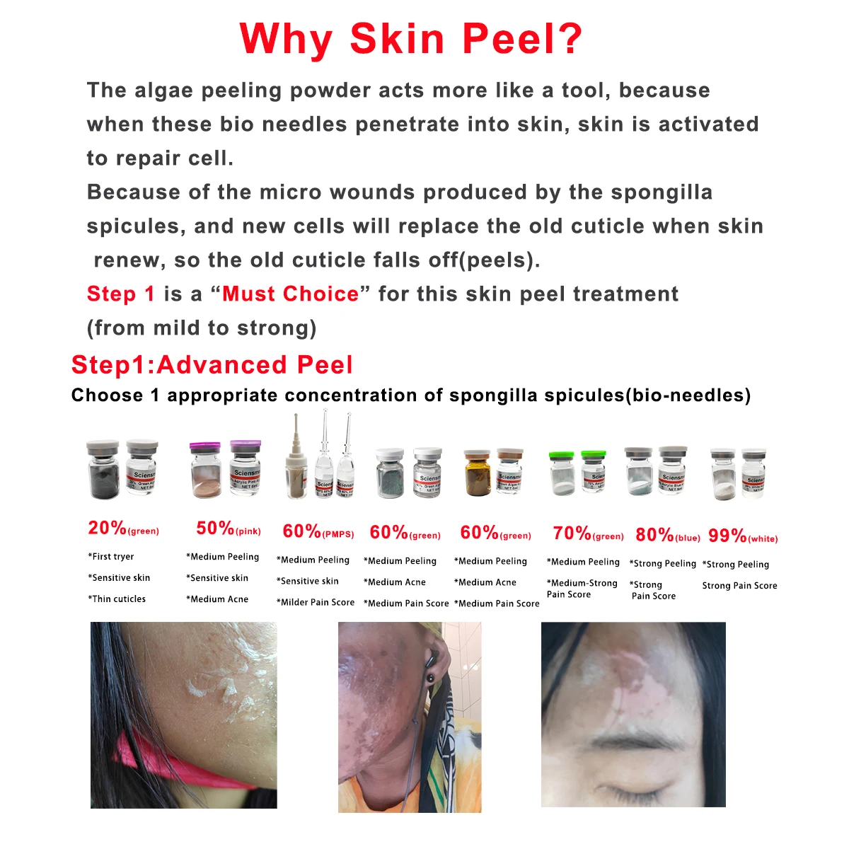 Epidermal Growth Factors Healing Power EGF Human Korea Like for Post Algae Chemical Peel Microneedling Micro Needling Serum