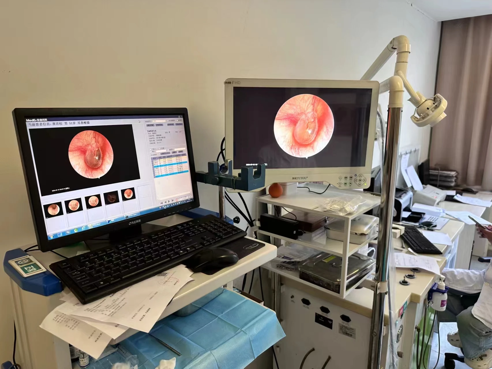 24inch Compact Medical Portable Endoscope Camera Gynecology Instruments for Hysteroscope