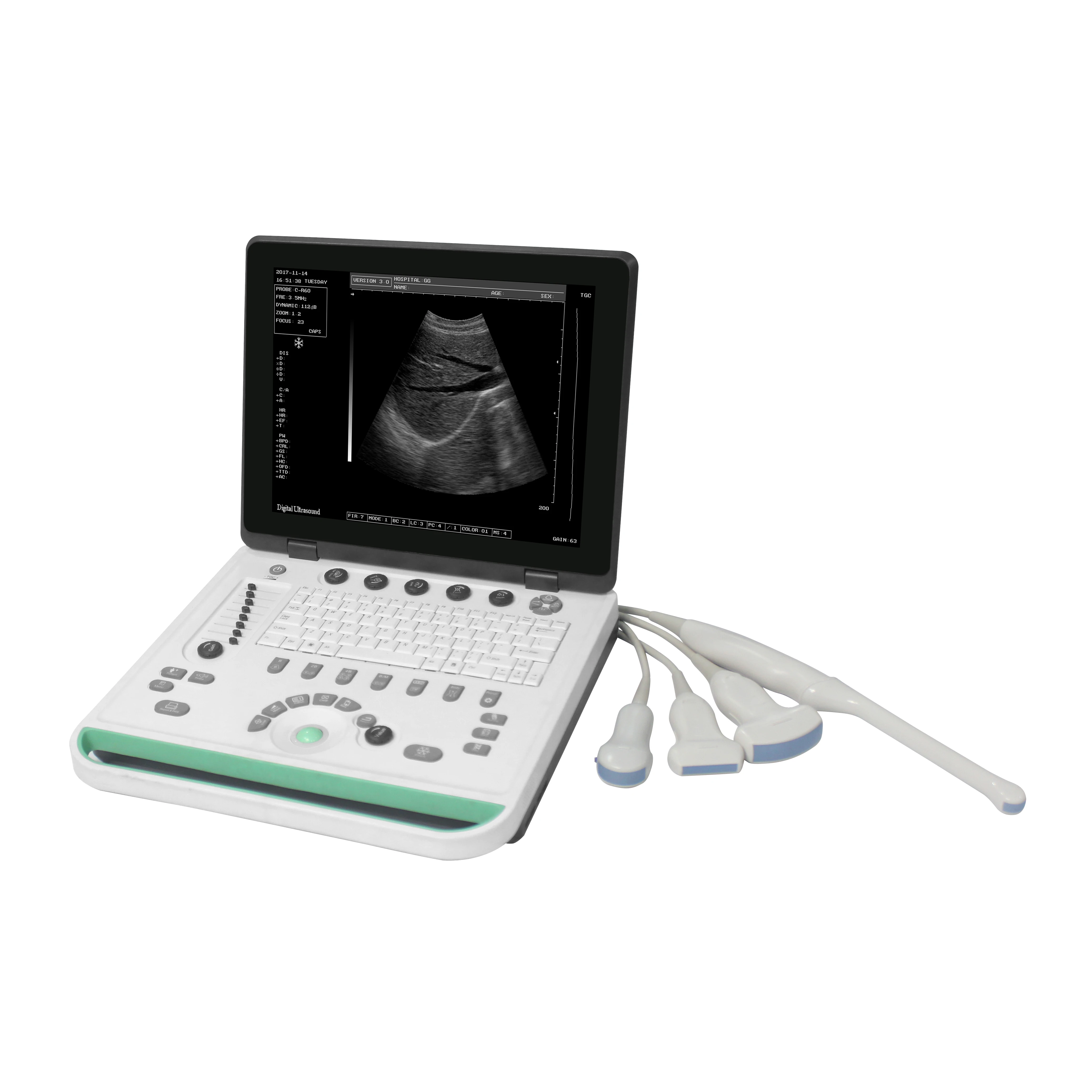 MN-Ultra1Cheap Usg Portable Bw/color Veterinary Ultrasound For Dogs Cats Sheep Horse