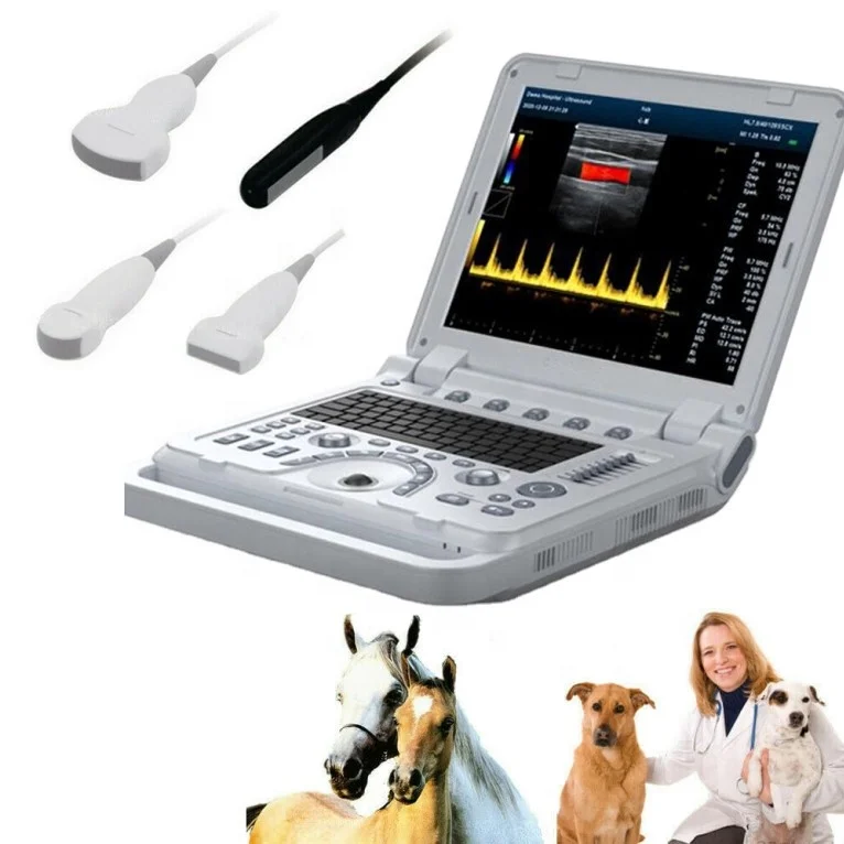 Contec Ultrasound Scanner System Ultrasound Machine/Medical Diagnostic Ultrasound Doppler 5D