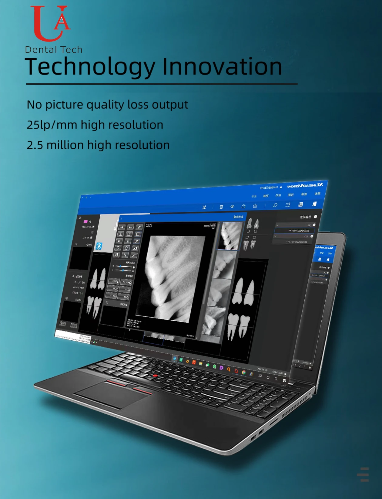 Foshan UAdental Easy Operation Superior Image Quality Radiografia X-ray RVG Sensor dental