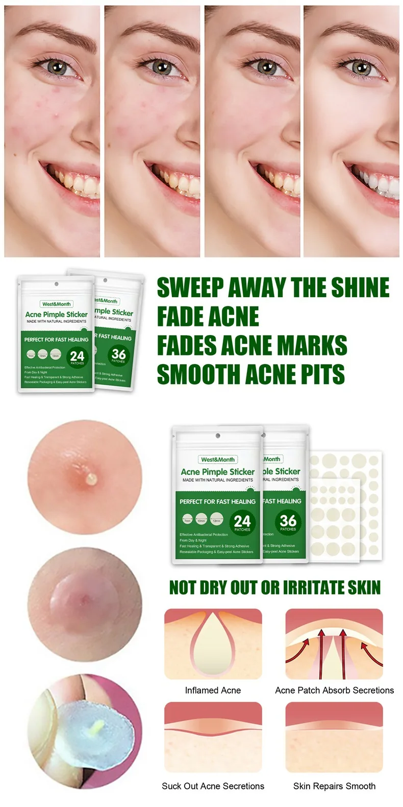 Free Sample Acne Dressing Acne Patch Custom Shape Spot Treatment Plaster Acne Patches Invisible