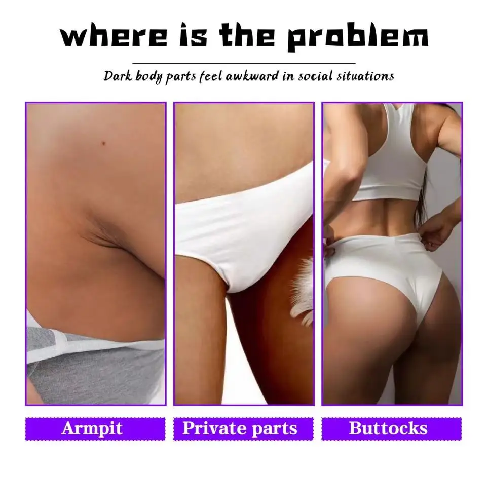 Bleaching Inner Thigh Face Whitening Cream Skin Brightening And Lightening Dark Spot Corrector For Dark Area Armpit