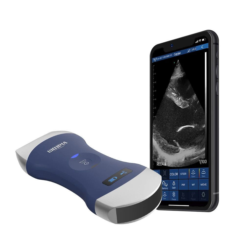 Профессиональный портативный допплер Viatom диагностическое решение всего тела ручной ультразвуковой сканер с выпуклым/линейным зондом и