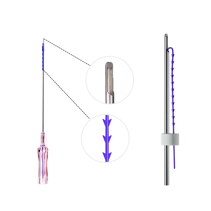 Factory Pdo Facial Lifting Thread fish bone W needle 18G 100MM Neogenesis Rejuvenation Pdo thread for face