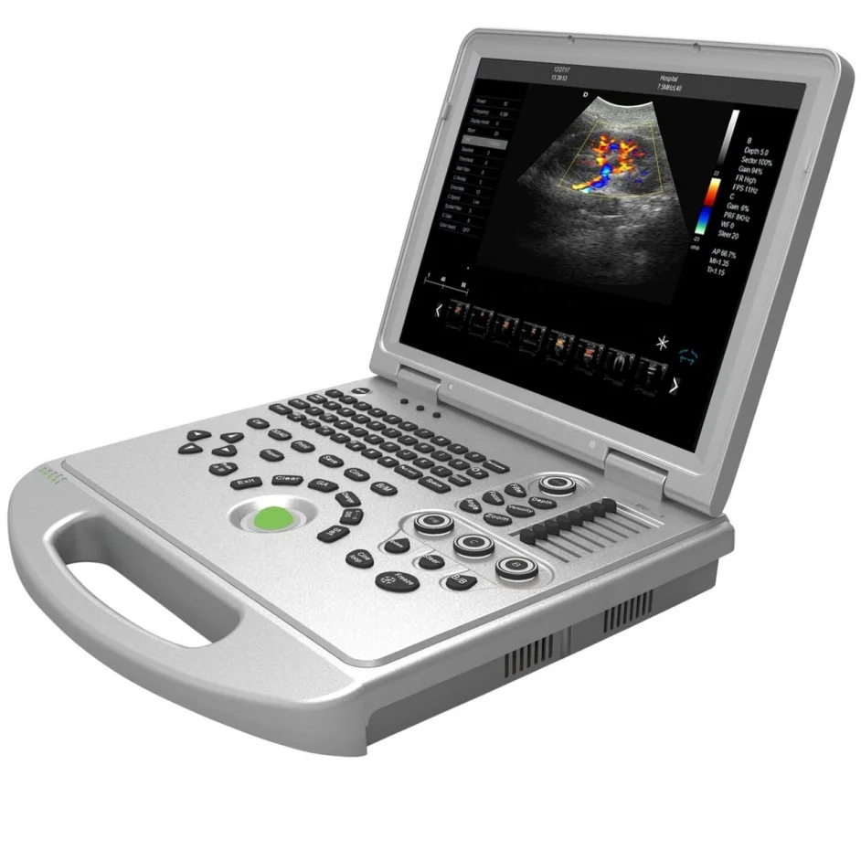 Dawei Ultrasound Machines/4D 5D Ultrasound Portable Ultrasound Machine for Human