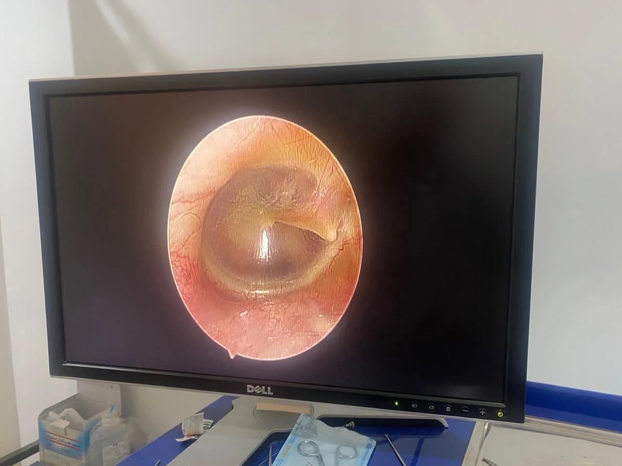 Hospital multi function integrated full HD endoscope camera for laparoscopy endoscope system