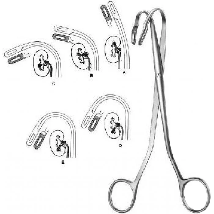 Новое качественное оборудование для урологической хирургии