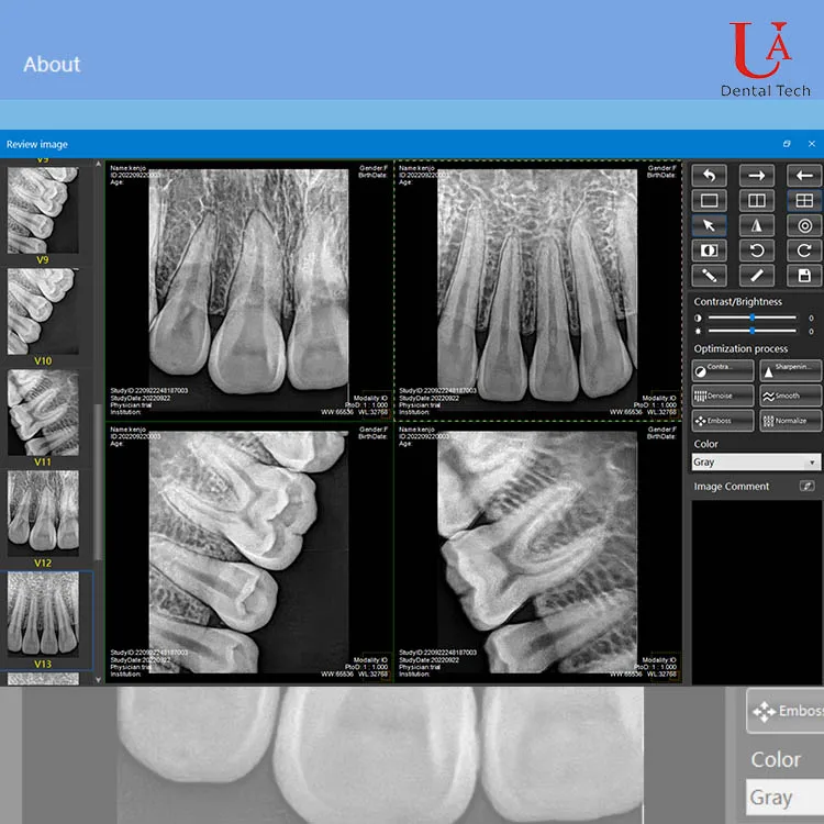 Foshan UAdental Easy Operation Superior Image Quality Radiografia X-ray RVG Sensor dental