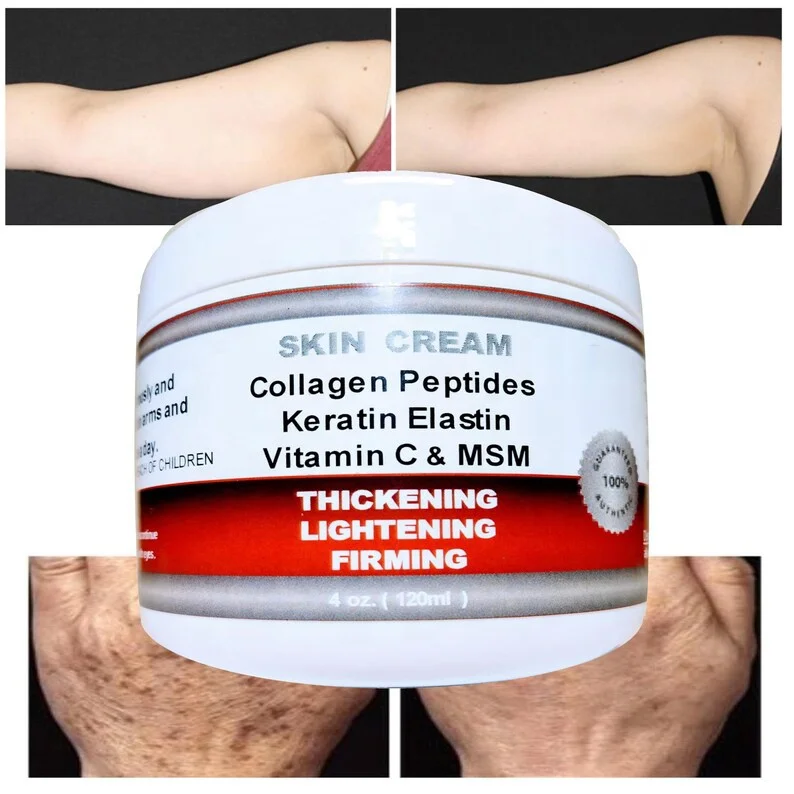 Saggy Skin Arms Hands Neck Thickening Wrinkled Skin Firming Cream with Collagen Peptides Elastin Vitamin C Natural Ingredients