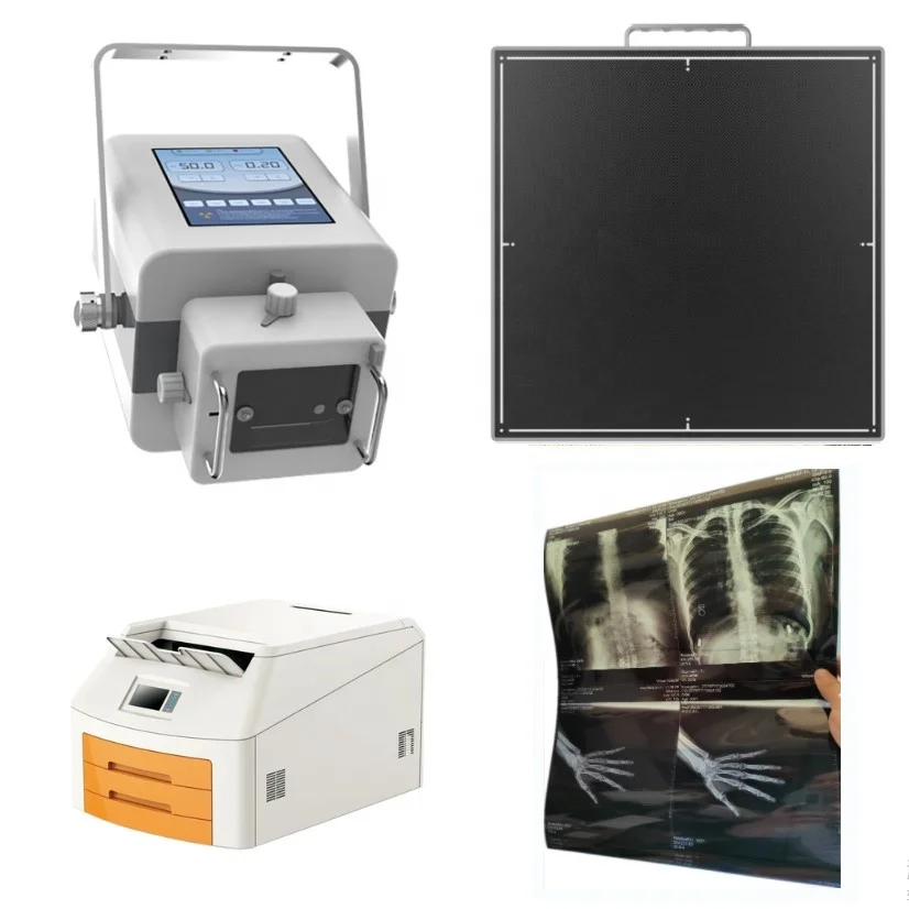 Medical Portable High Frequency Radiography X Ray Machine for Human and Vet