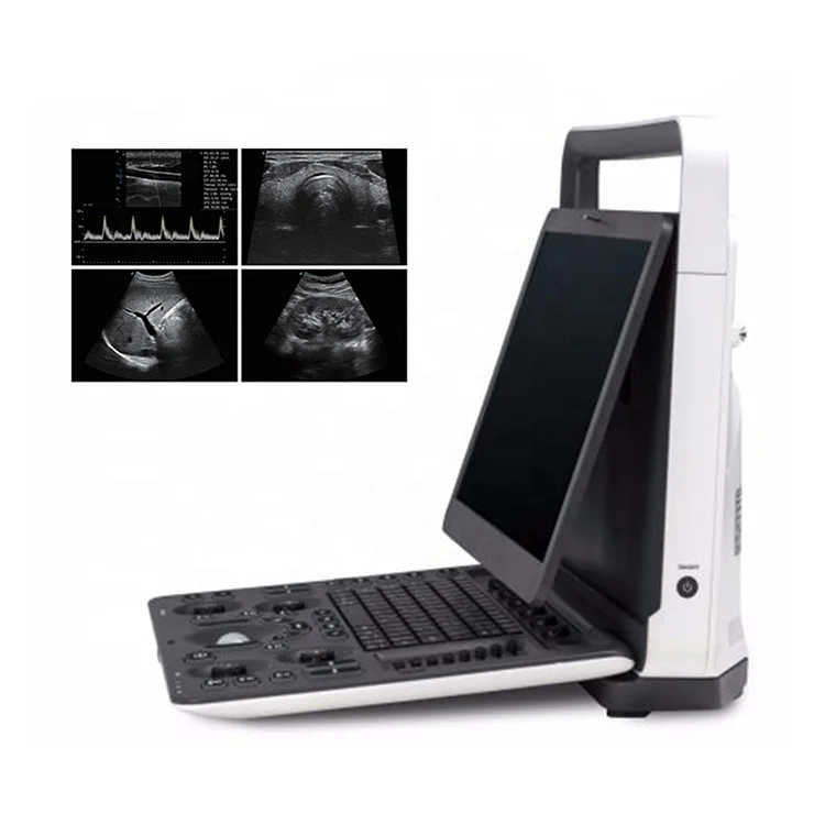 Sonoscape E2 Ultrasound Machine Color