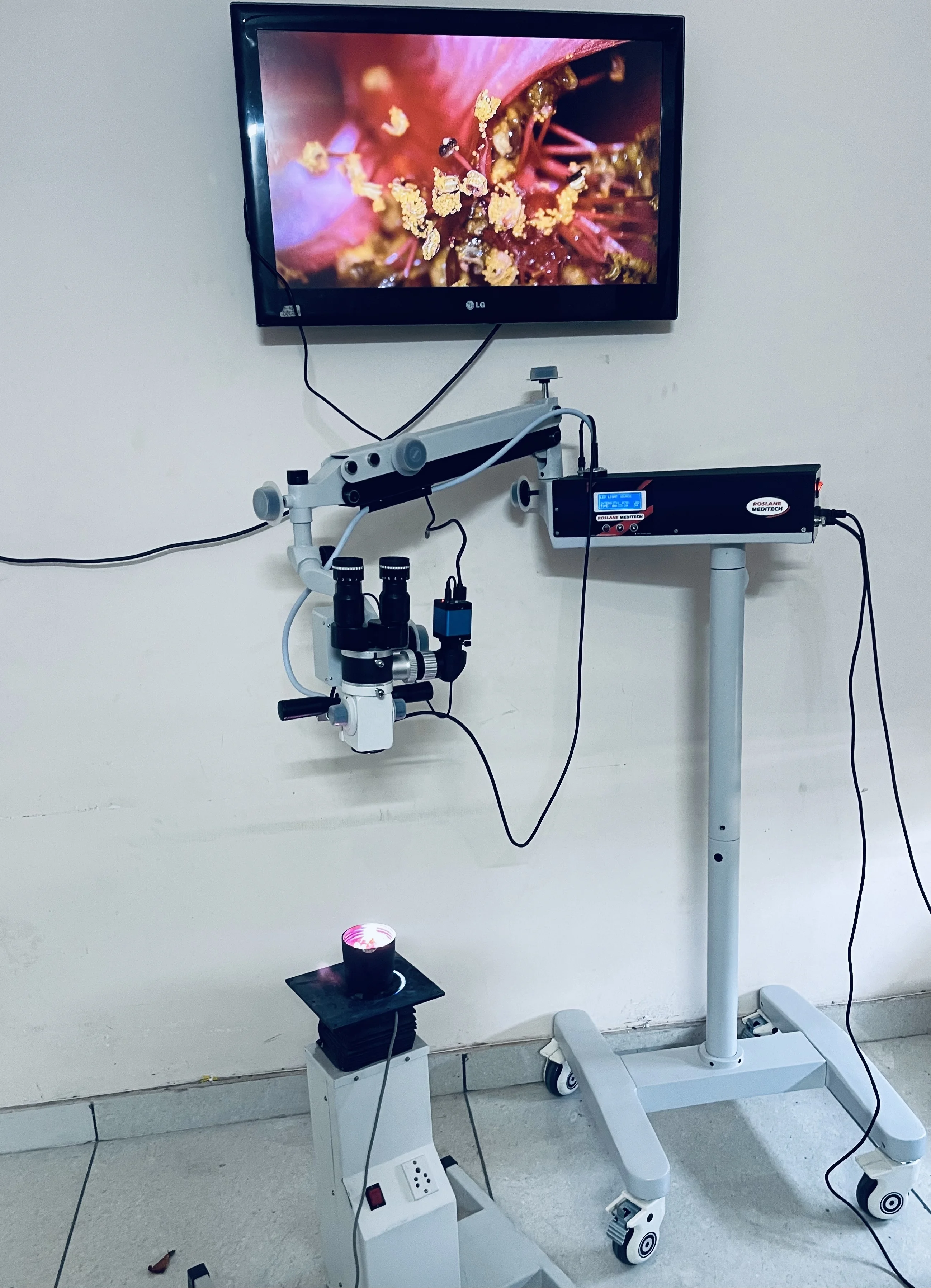 ROM-6 Professional ENT Operating Microscope for Microsurgery for Ear Operations and Procedures