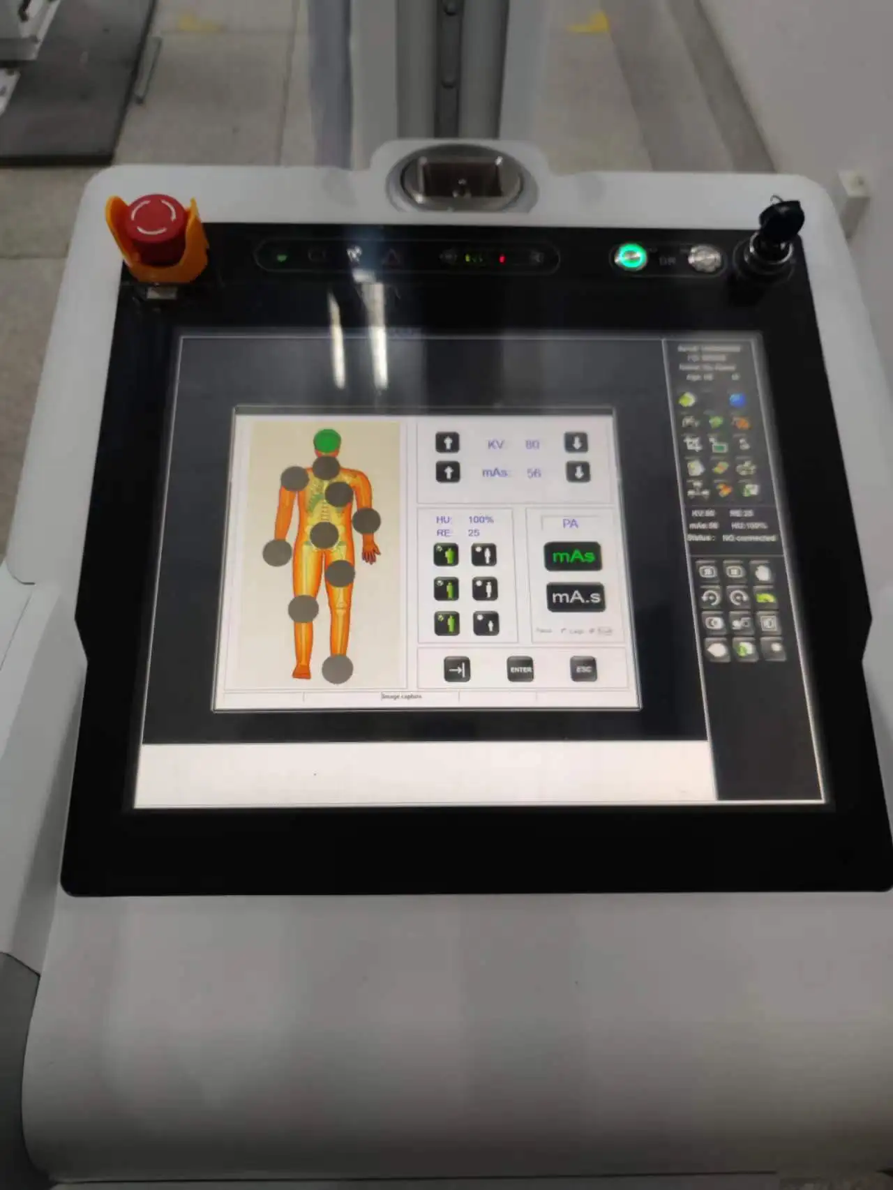 Perlove Medical With Spot Wholesale PLX5300 xray machine digital Portable Digital Radiography X-ray Machine