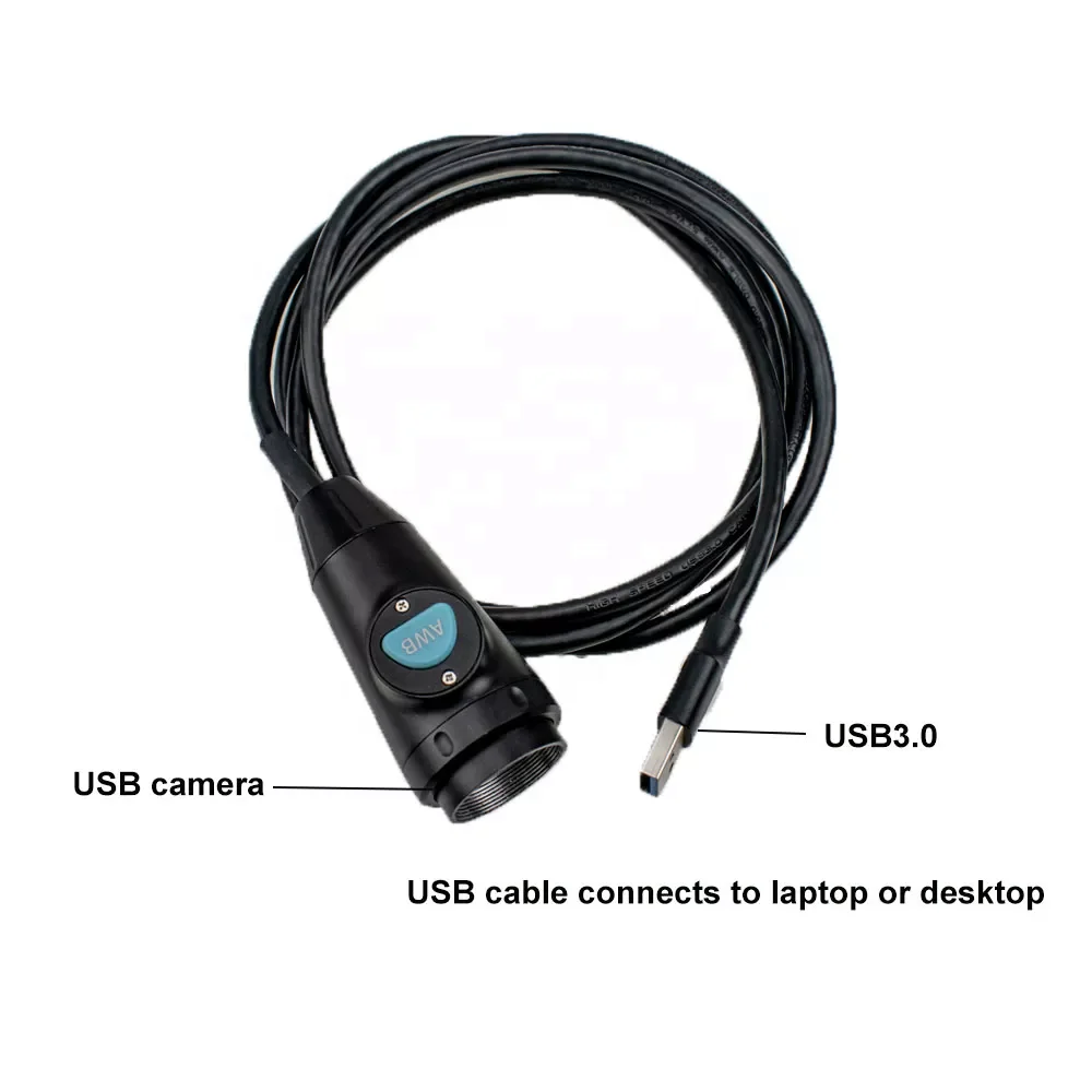 Tuyou 1080p Portable USB3.0 PC Laptop Endoscope Camera Compatible with ENT Otoscopy Sinuscope Laryngoscope Nasal Ear Endoscopy