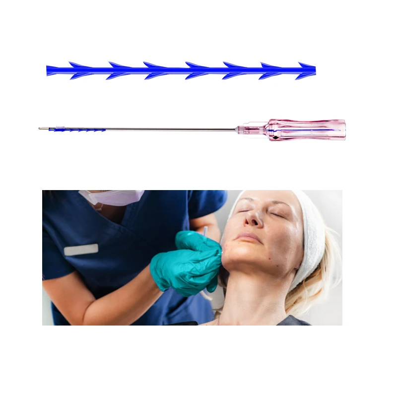 Factory Pdo Facial Lifting Thread fish bone W needle 18G 100MM Neogenesis Rejuvenation Pdo thread for face