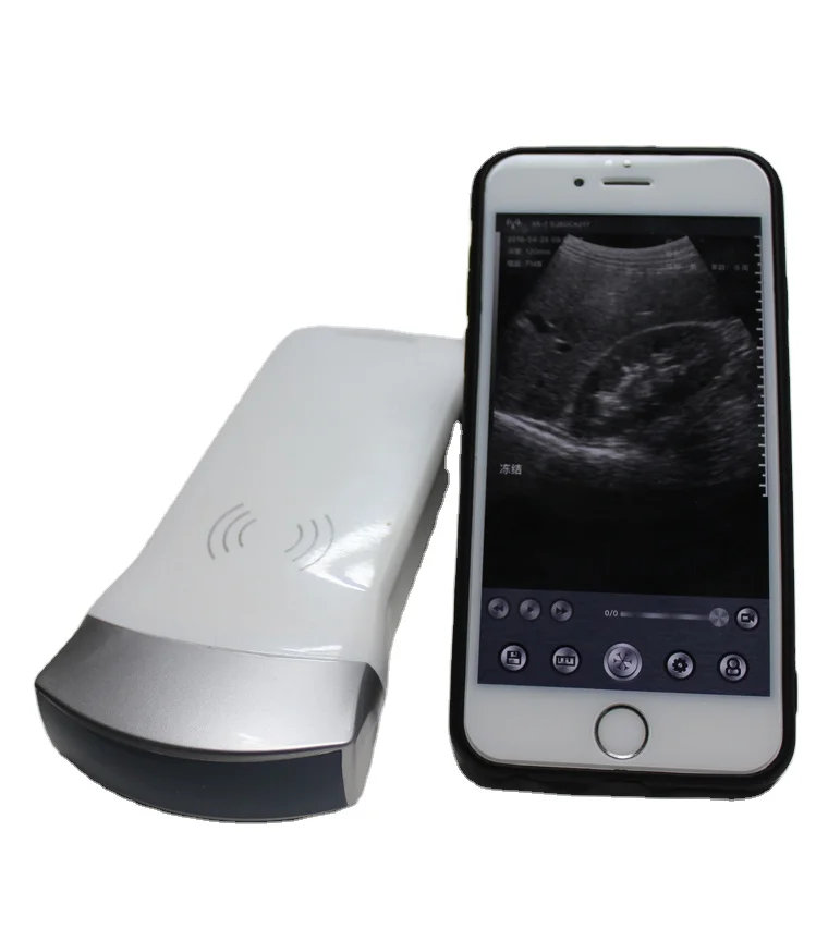 wireless android/ios convex array usb ultrasound probe ultrasound scanner pocket ultrasound for sale price