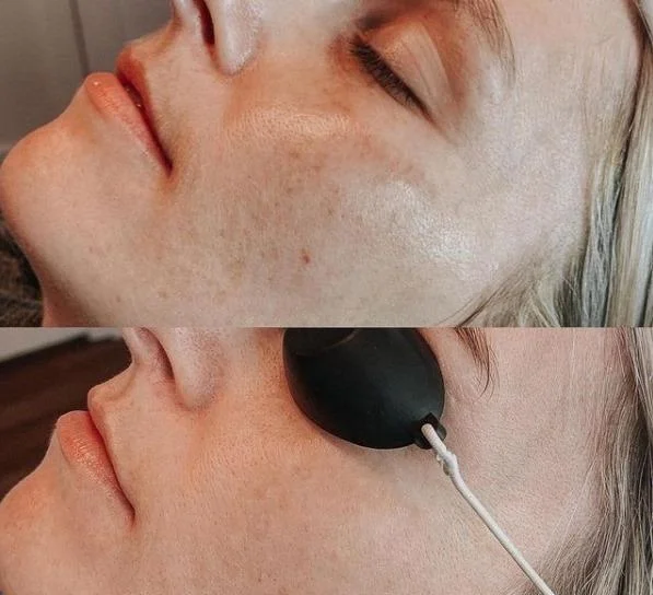 IPL OPT Elight hair removal skin tightening machine Photorejuvenation IPL beauty machine CE approved