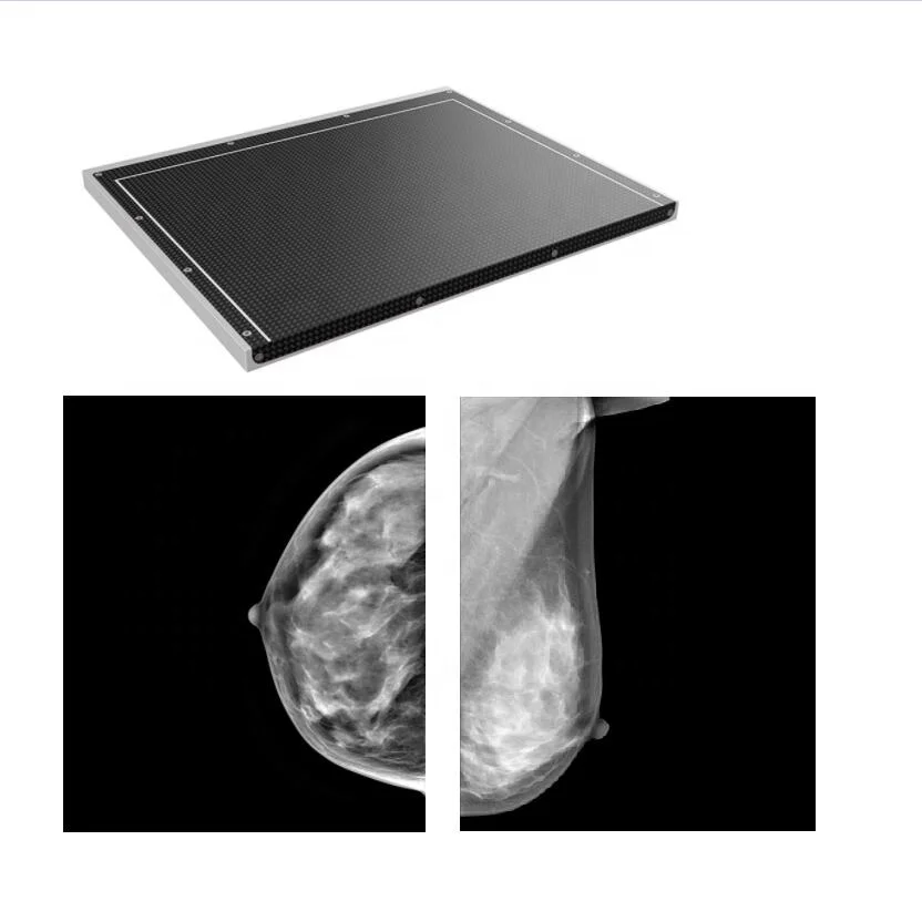 10*12 Inch Cassette Size Mammography Flat Panel Detector for Digital Mammography X Ray Machine