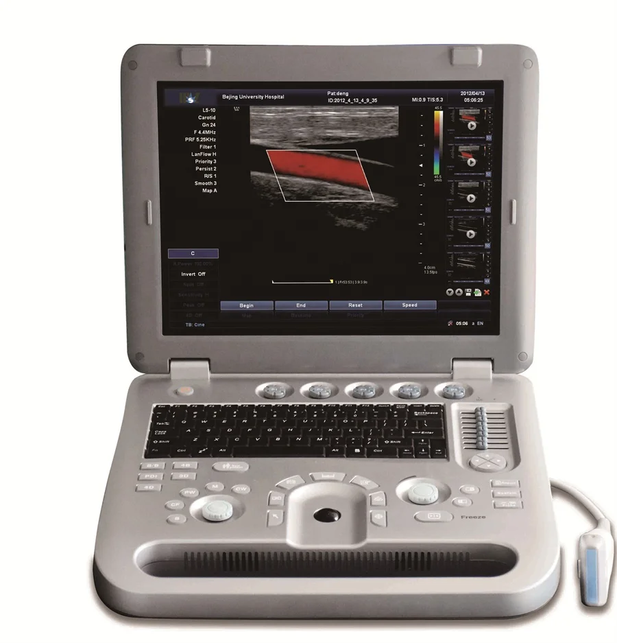 Contec Ultrasound Scanner System Ultrasound Machine/Medical Diagnostic Ultrasound Doppler 5D