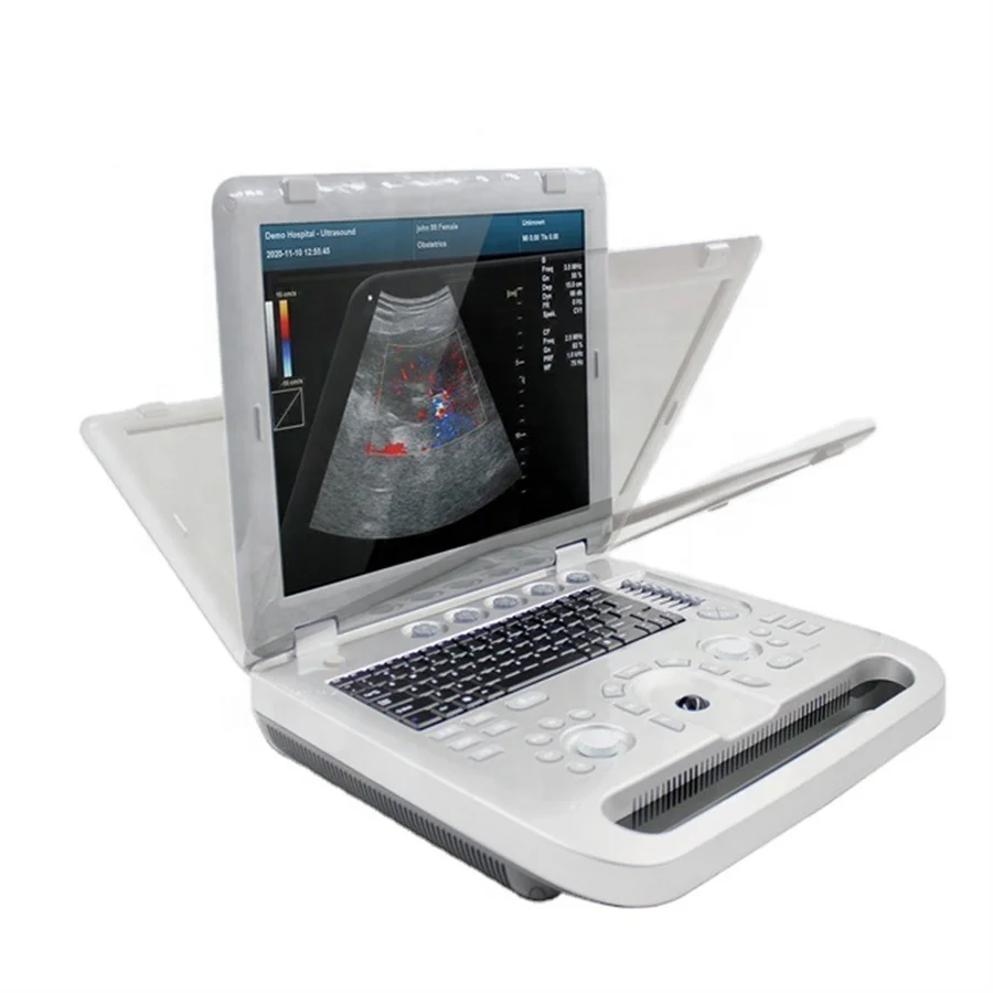 Contec Ultrasound Scanner System Ultrasound Machine/Medical Diagnostic Ultrasound Doppler 5D