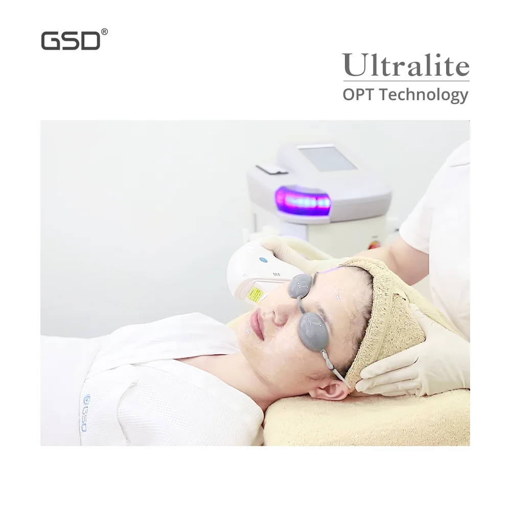 GSD Upgrade Professional 2 handpiece pain free hair removal OPT ipl machine