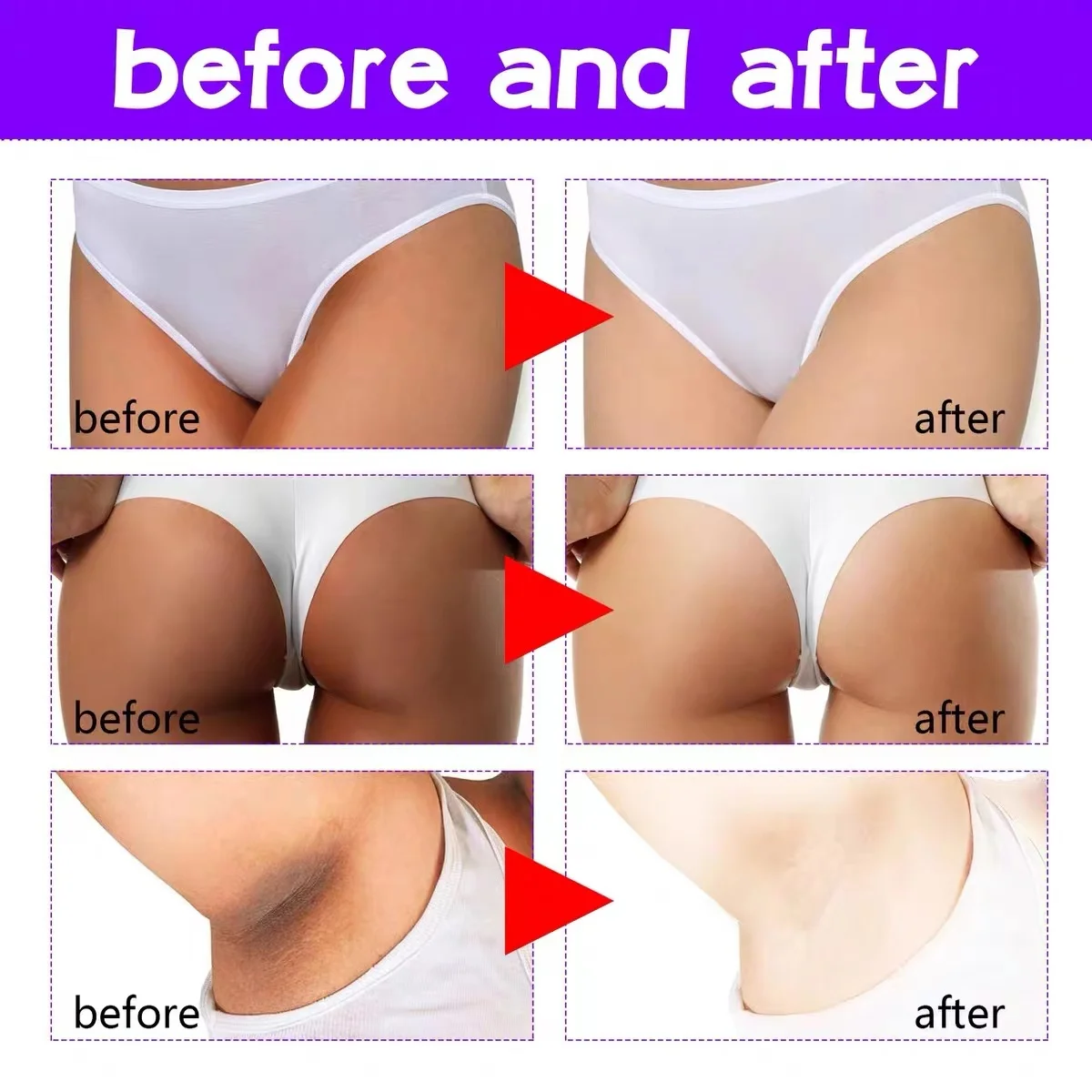 Bleaching Inner Thigh Face Whitening Cream Skin Brightening And Lightening Dark Spot Corrector For Dark Area Armpit