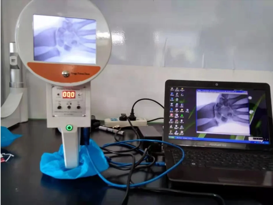X Ray Machine Portable/ C Design X-Ray Machine for X  Ray Diagnosis
