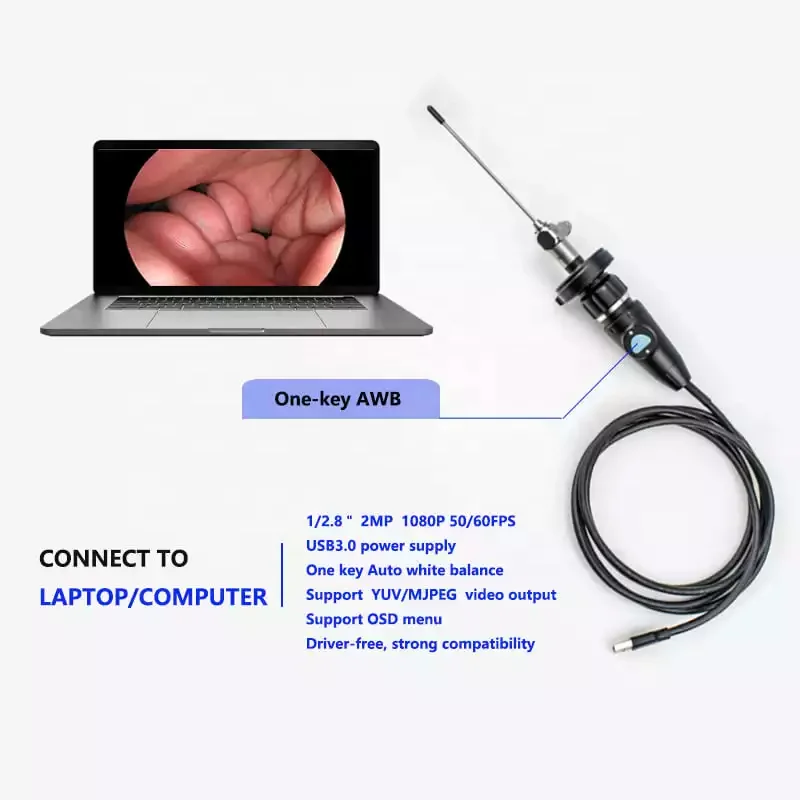 Tuyou 1080p Portable USB3.0 PC Laptop Endoscope Camera Compatible with ENT Otoscopy Sinuscope Laryngoscope Nasal Ear Endoscopy