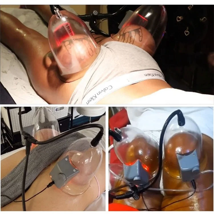 Portable breast enhancement Personal Care vacuum therapy buttocks lifting machine butt lift machine vacuum cups