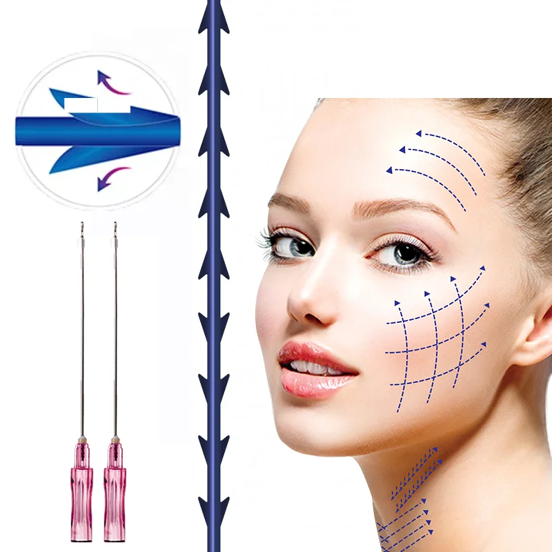 Factory Pdo Facial Lifting Thread fish bone W needle 18G 100MM Neogenesis Rejuvenation Pdo thread for face