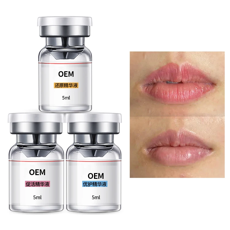 Remove Dark Lips Care Whitening Bleaching African Lips darklips tattoo