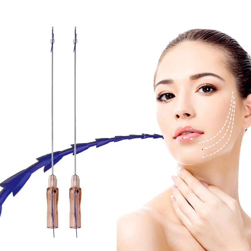 Factory Pdo Facial Lifting Thread fish bone W needle 18G 100MM Neogenesis Rejuvenation Pdo thread for face
