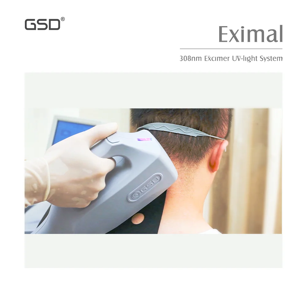 GSD Professional Eximal Skin Treatment UVB Phototherapy UV Lamp Equipment 308 Excimer Laser Psoriasis Vitiligo Laser Machine
